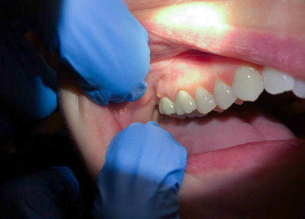 Best Walk-In Emergency Dental Services in Ashland, IL